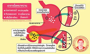 การรักษาโรคเบาหวานด้วยแพทย์แผนจีน