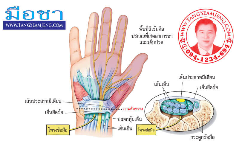 มือชาเท้าชา